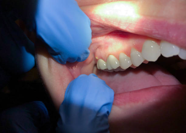 Best Emergency Dental Care for Trauma or Injury in Han, GA
